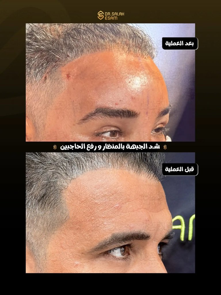 Story image