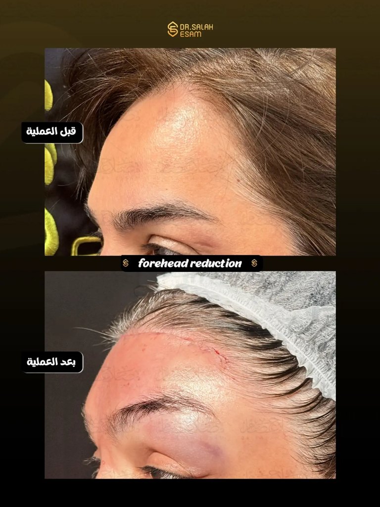 Story image