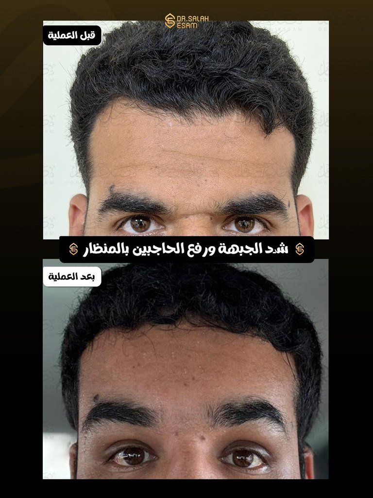 Story image