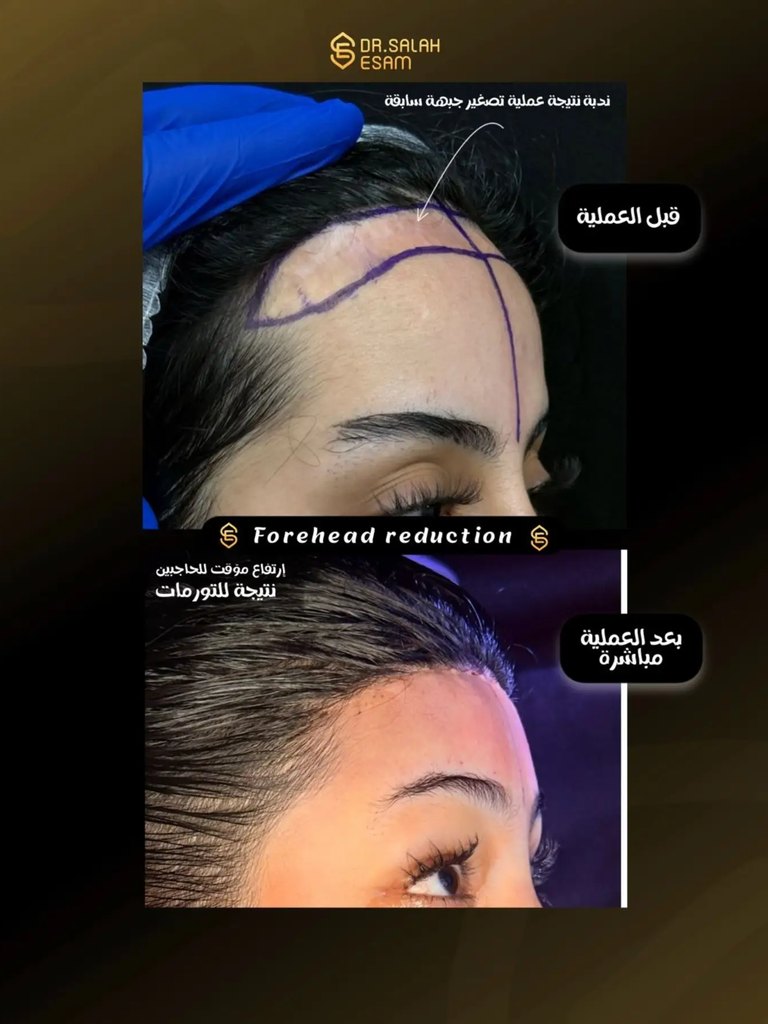 Story image