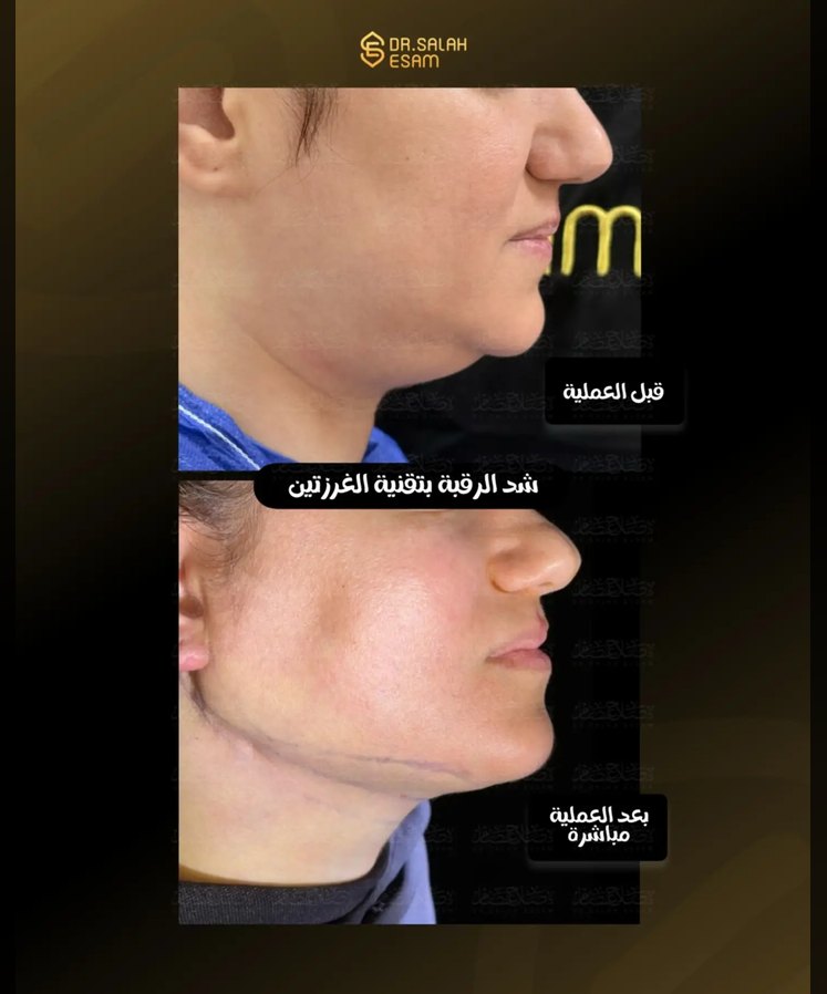 Success image